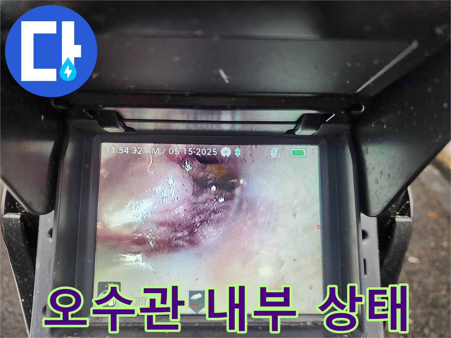 중랑구-오수관-내시경-이물질-검사