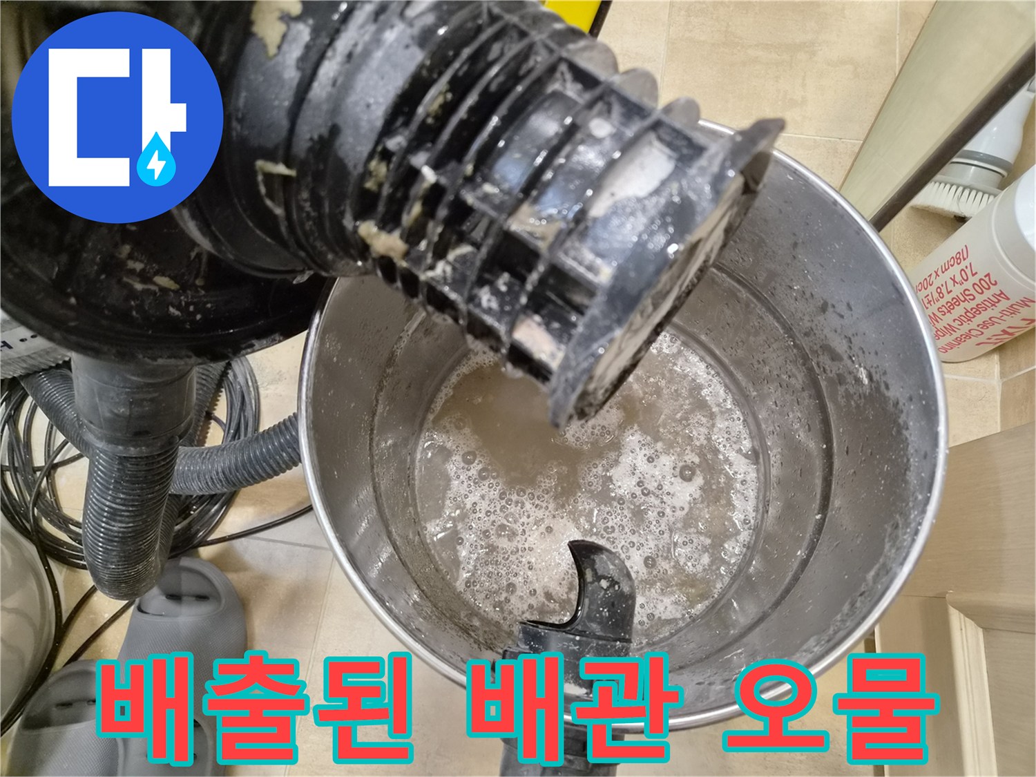 석션 작업으로 추출된-탁한 배액과 이물질